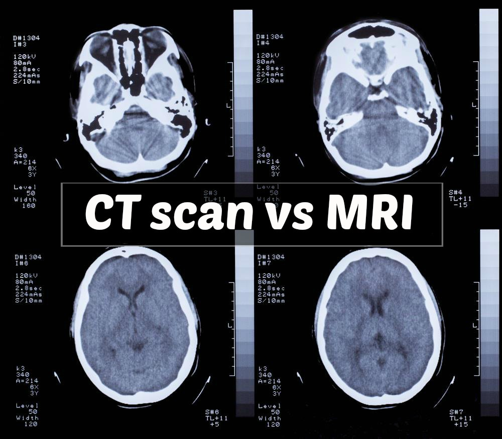 Deep Learning For Medical Imaging And Diagnosis